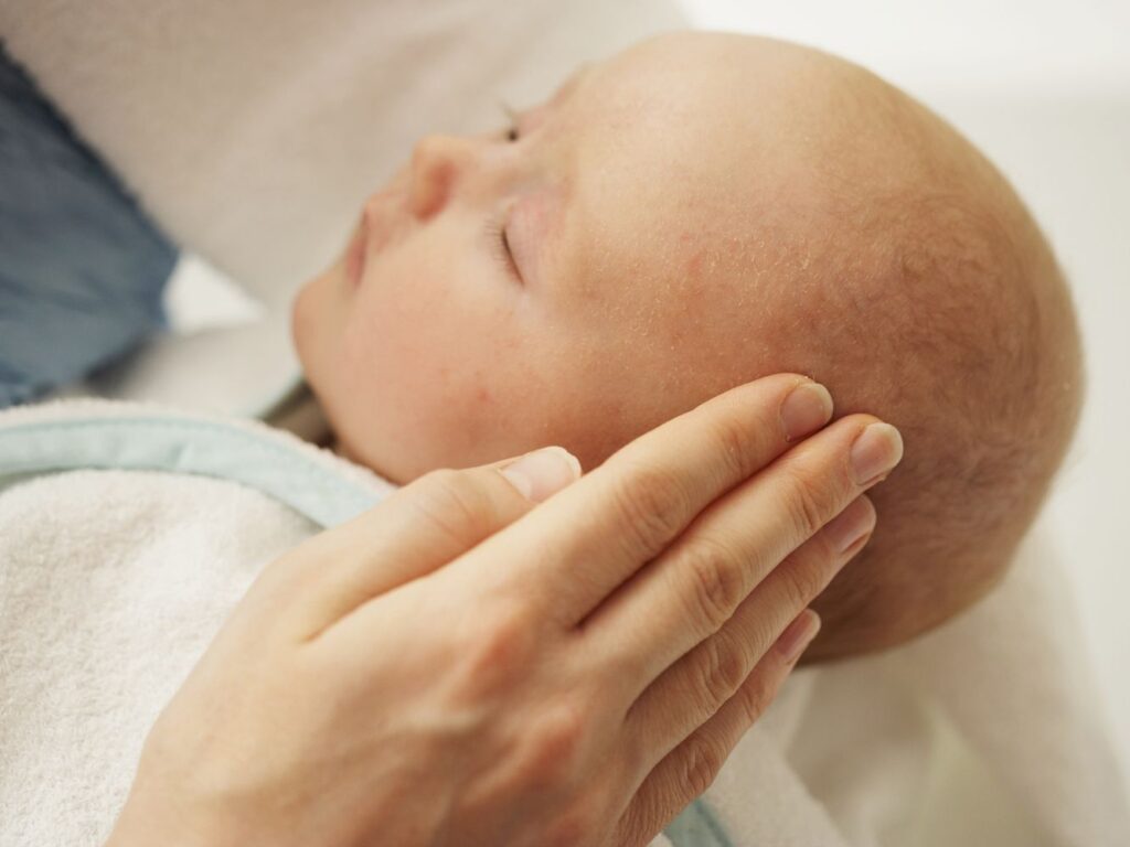 Child Healthy skin – Treating Support Cap and Nappy Rash Normally